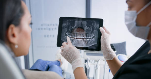 Licensed Wisdom Tooth Removal service in Great Neck, NY - Smile Center Dentistry